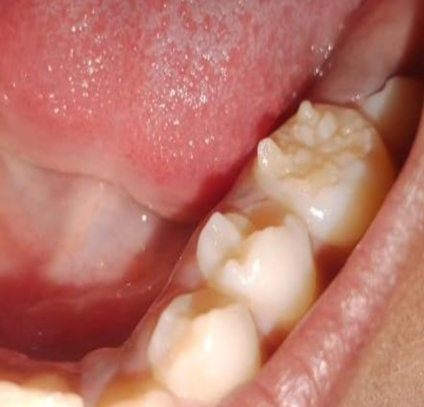 Follow-up image after 24 months