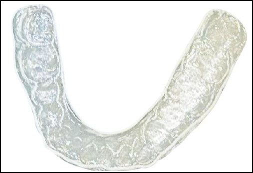 Intaglio (tissue-contacting) surface of the finished and polished soft night guard
