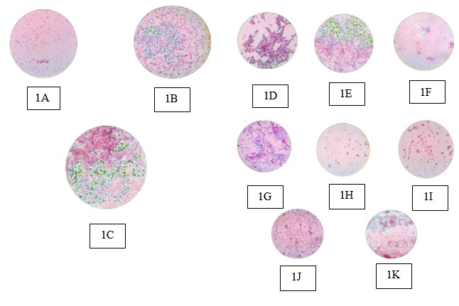 Image of Differentiating Pathogenic Bacteria through Biochemical Markers: A Study for Clinical Applications