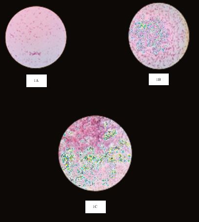 Image of Differentiating Pathogenic Bacteria through Biochemical Markers: A Study for Clinical Applications